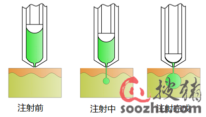 獸用無針注射器 現(xiàn)代化獸醫(yī)醫(yī)療器械的創(chuàng)新與優(yōu)勢(shì)